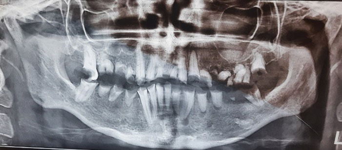 ajdr-14-185-g002