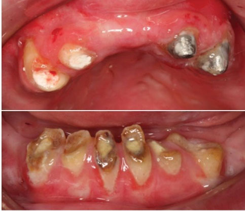 ajdr-14-185-g007