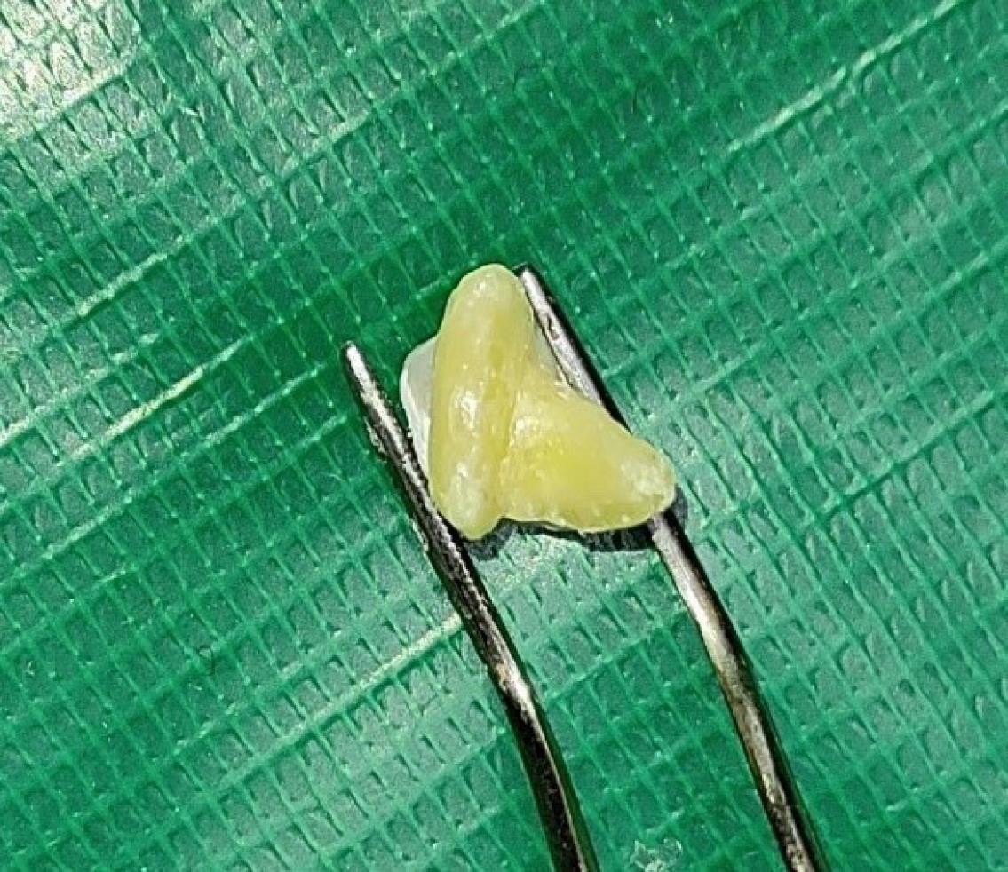 ajdr-17-101-g002