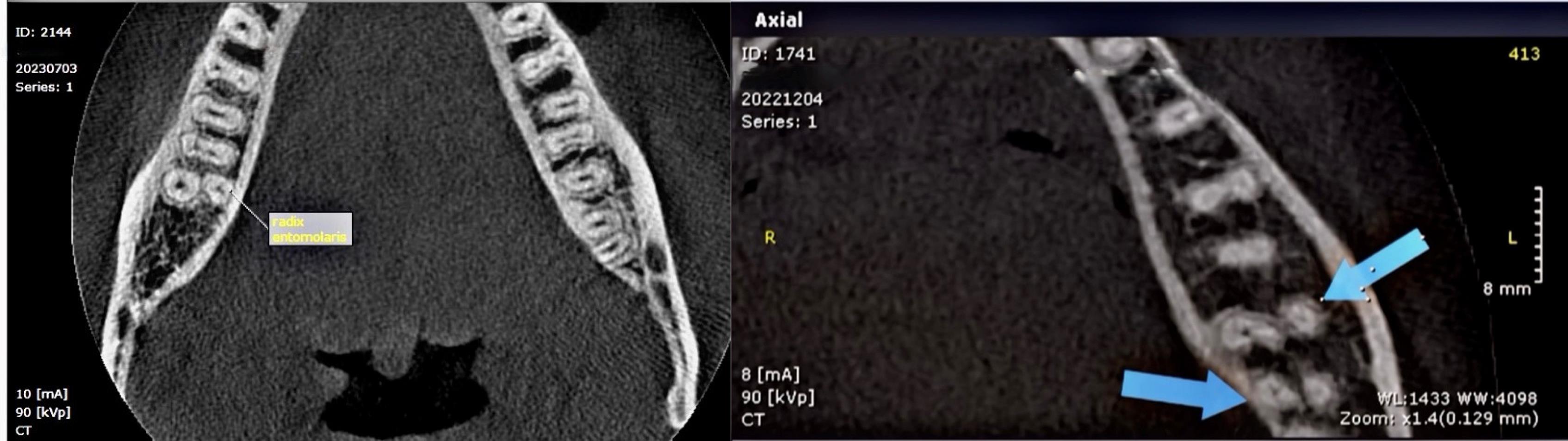 ajdr-17-109-g002